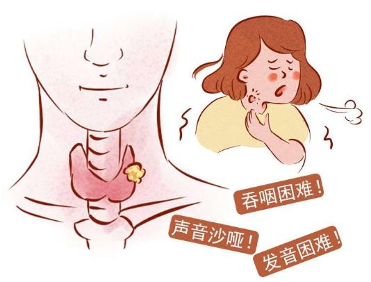 咽炎