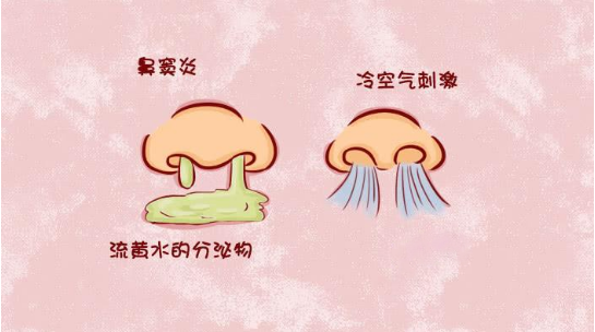 儿童鼻窦炎的早期症状