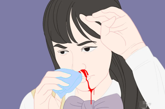 鼻出血
