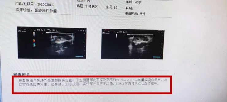 重庆耳鼻喉专业医院检查结果