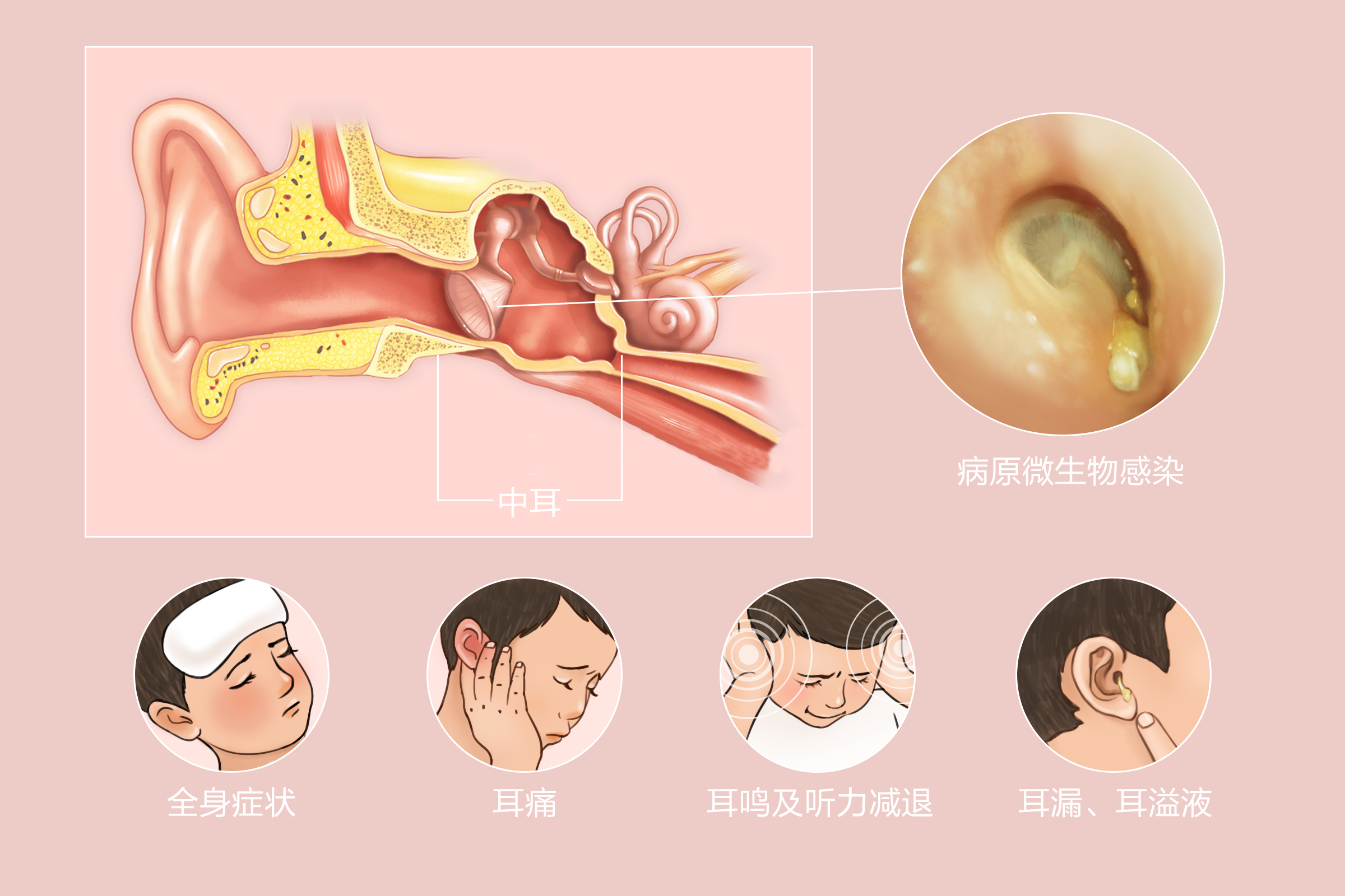 重庆治疗中耳炎专科医院